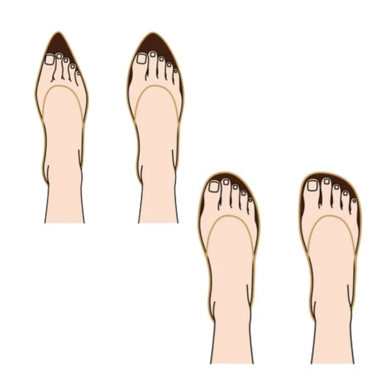 وقتی پاها درخواست مرخصی میکنند!|نقش کفشها در سلامت پاها عوارض پوشیدن کفش های تنگ برای مدت طولانی